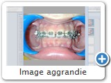 Image aggrandie