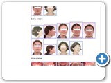 Vue patient